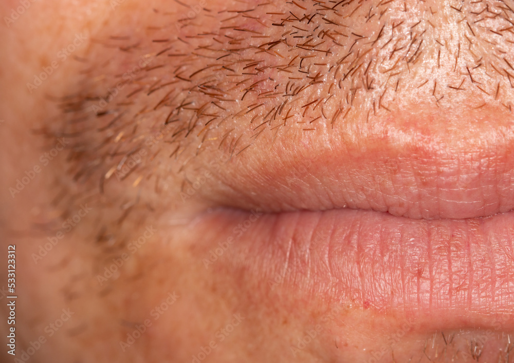 Fototapeta premium Hair on the skin of a man's face. Macro