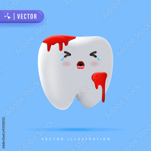 3D Realistic Bleeding Teeth Vector Illustration. Suitable for Children Dentistry Clinic Poster Design.