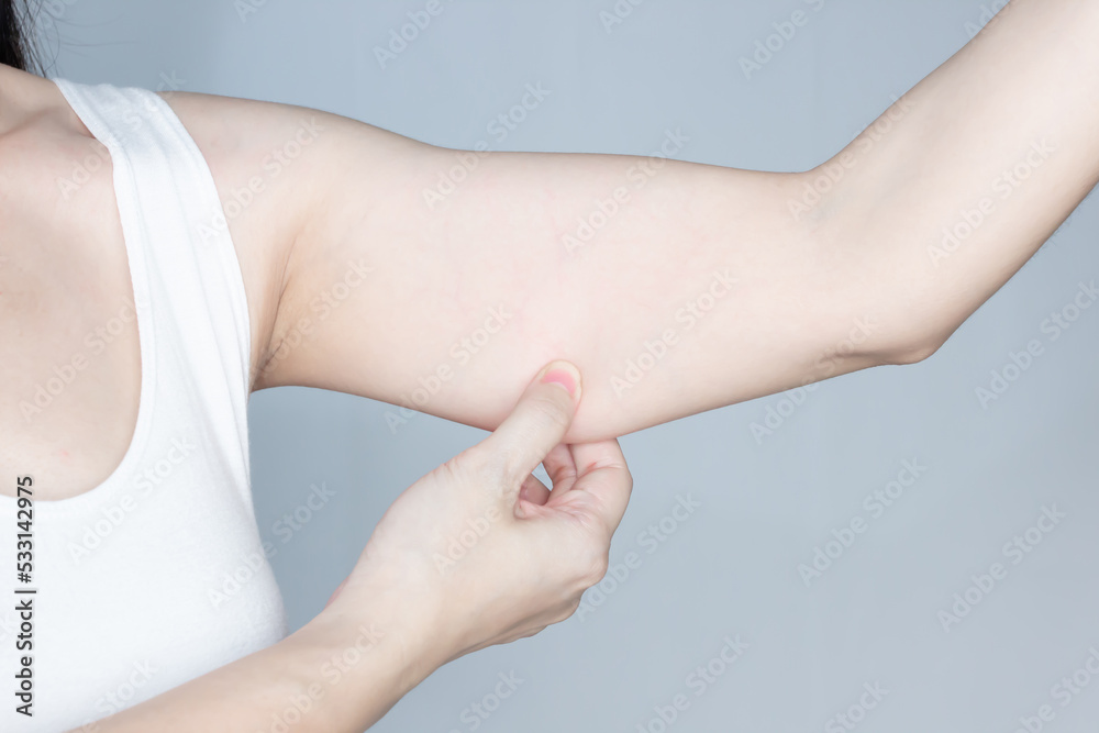 Woman is pulling underarm muscle with excess of cellulite. Fat, flabby and overweight Woman is pulling underarm muscle with excess of cellulite. Fat, flabby and overweight