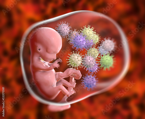 Fotografiet Transplacental transmission of Cytomegalovirus to human embryo