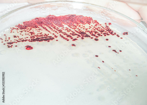 Red colonies of photosynthetic bacteria on culture medium agar. Streak plate technique. Microbiology concect photo