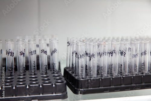 Group of test tubes containing patient samples ready for flow cytometry analysis. photo