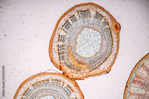 Plant tissue Structure, section (tissue) of stem plant tissue under a light microscope. photo