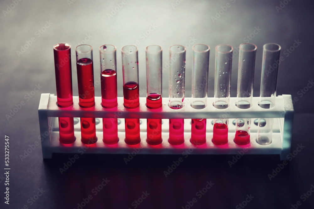 Microscopic examination of blood. Test tubes with red liquid on the ...