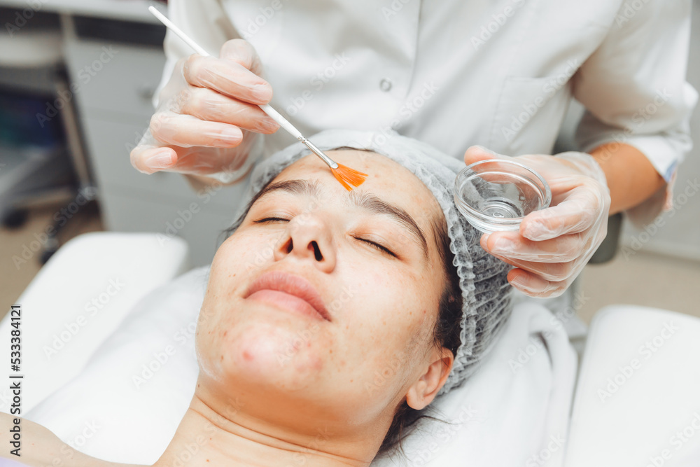 A cosmetologist does facial care and apply a face mask. cleansing a heavily soiled face. acne on the skin. skin rashes. mechanical face painting.