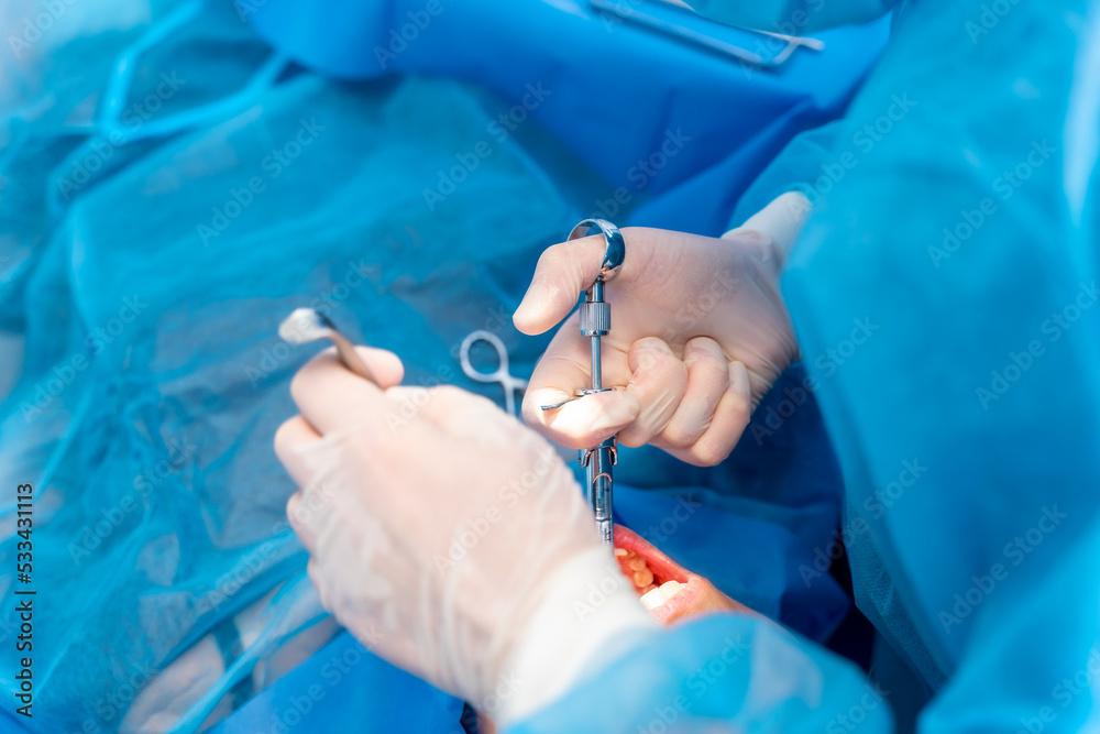Dental clinic, female dentist doctor applying anesthesia injection before operation Dental clinic, female dentist doctor applying anesthesia injection before operation