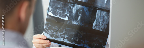 Doctor examining patients xray result in hospital on appointment with client photo