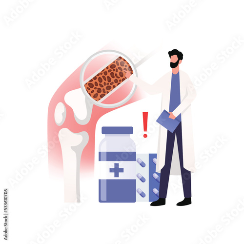 Medical Diagram of Deep Vein Thrombosis at leg area. Illustration about abnormally of blood floow.