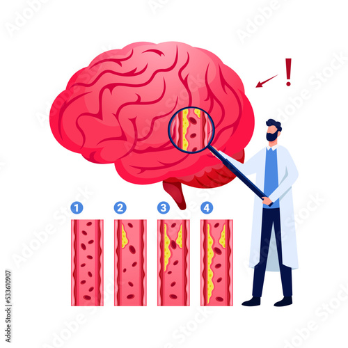 World Stroke day banner, mnemonic. Brain and human face vector.