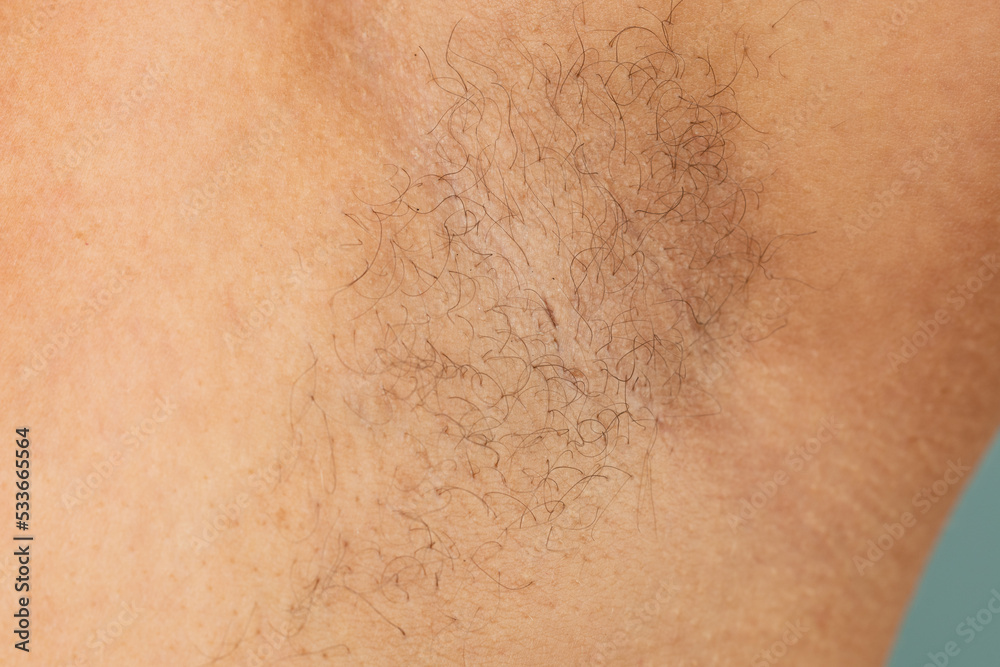 Person with hairy underarms closeup, free copy space, skin background. Arm with armpit hair. Female beauty trend, freedom, sensitive skin, growing body hair, feminism, body positive, naturalness.