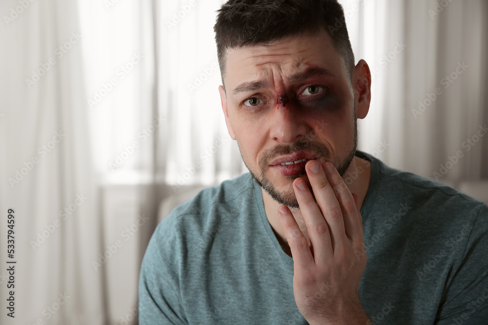 Man with facial injuries at home, space for text. Domestic violence victim Man with facial injuries at home, space for text. Domestic violence victim