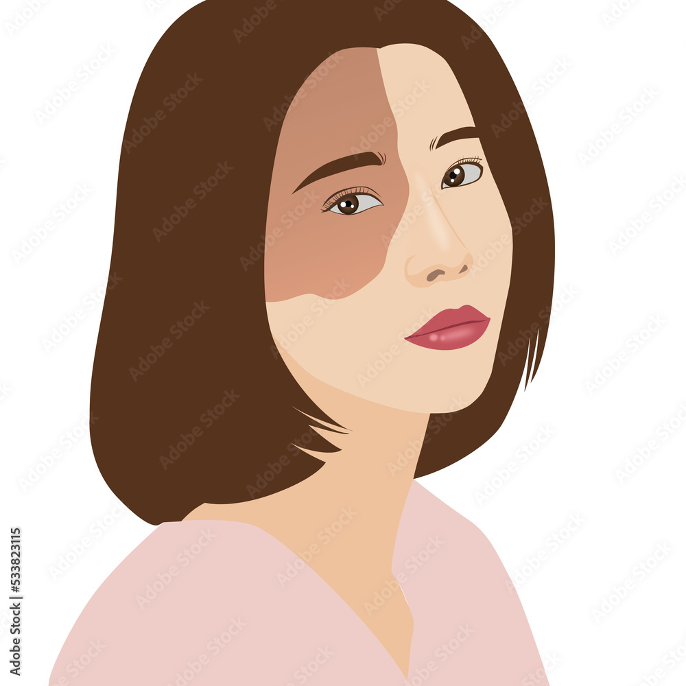 Red birthmark nevus of ota on females face, illustration on white background Red birthmark nevus of ota on females face, illustration on white background