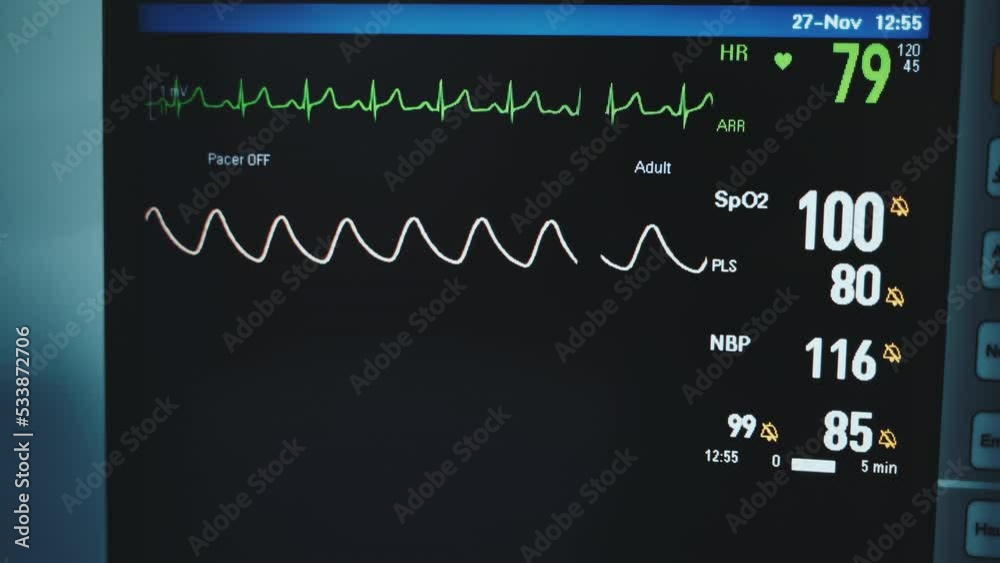 Black screen with two wavy lines running. Monitor with patient's vital