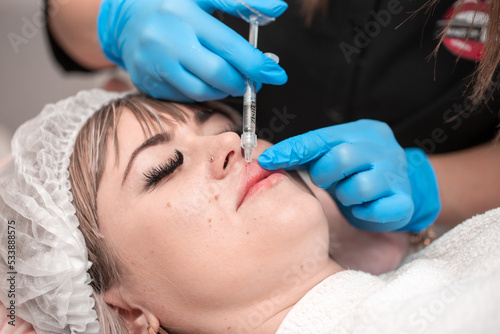 Lip augmentation. Beautician injects hyaluronic acid into the lips of a girl with a syringe. The cosmetologist doctor performs the procedure in the cosmetology office. Plastic surgery.