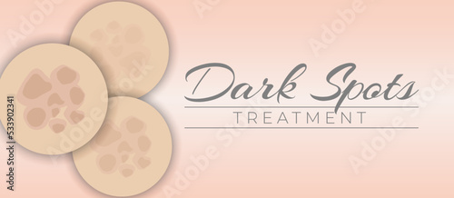 Dark Spots Fading Treatment Illustration Banner Background