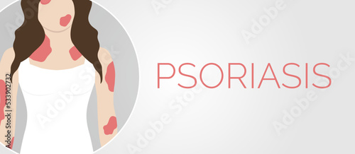 Psoriasis Skin Illness Background Illustration Design