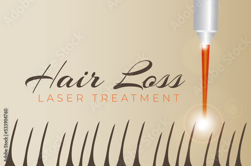Hair Loss Treatment Illustration with Laser