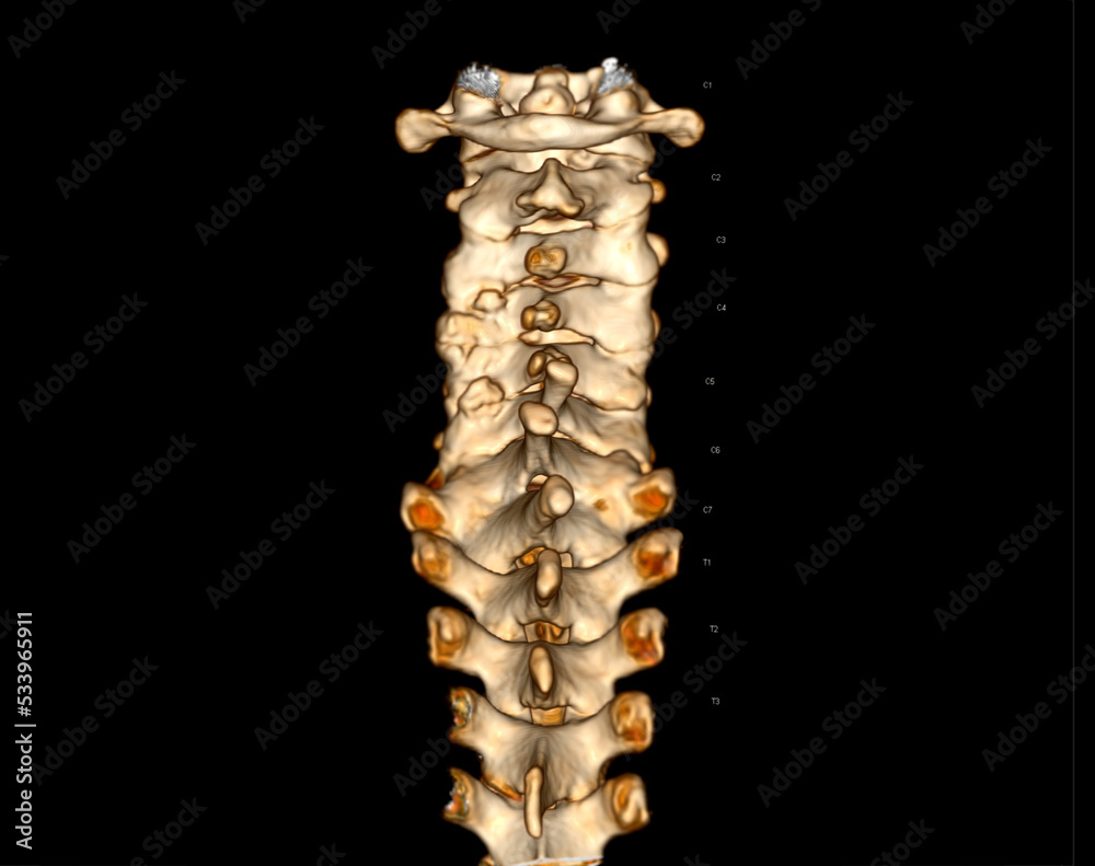 CT scan of C-Spine or Cervical spine 3D rendering .