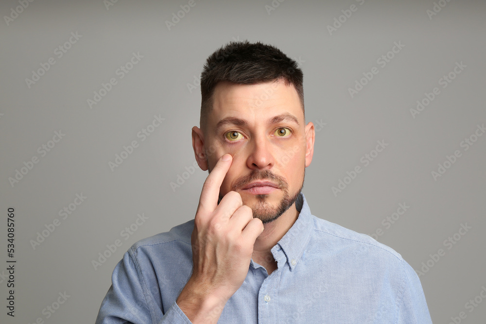 Man checking his health condition on grey background. Yellow eyes as symptom of problems with liver Man checking his health condition on grey background. Yellow eyes as symptom of problems with liver