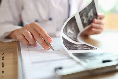Quadro su tela Gynecologist examines results of examination of uterus