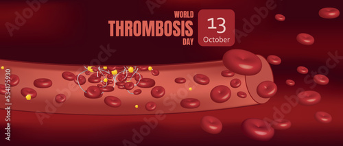 World Thrombosis Day. October 13. Poster and banner. Vector illustration of on red background .thrombus formation.