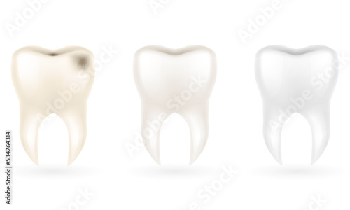 human root tooth model vector illustration