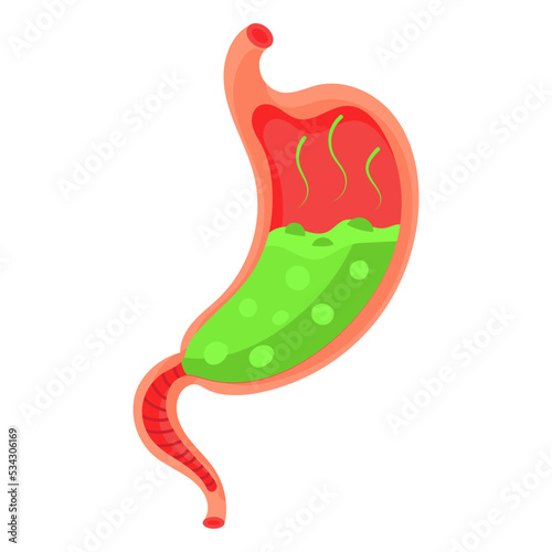 Full stomach. Heaviness of stomach, bloating, pain in the alimentary tract and acid heartburn. Duodenal problems and human organ health cartoon digestion system vector illustration.