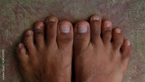 Male Foot with second toe longer than a big toe. LaMay toe, Morton's foot and Greek foot. photo