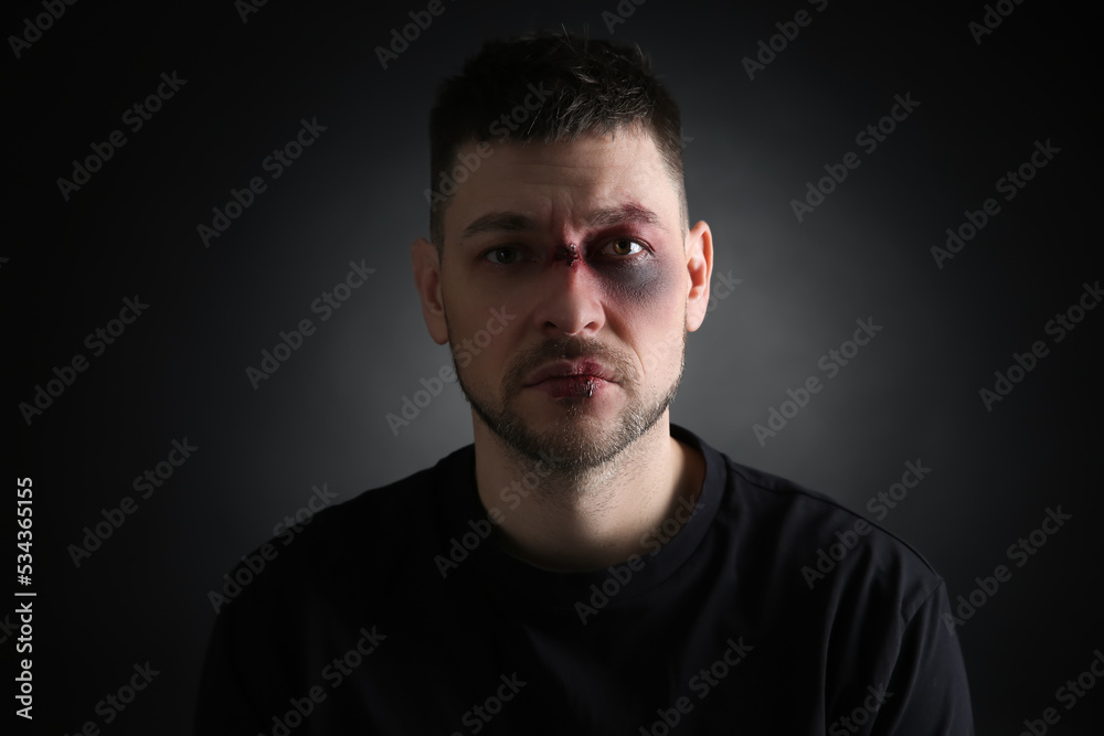 Man with facial injuries on dark background. Domestic violence victim