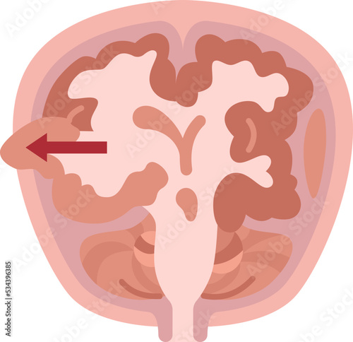 cerebrovascular icon