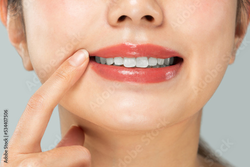 女性は白い歯を指差している。 
