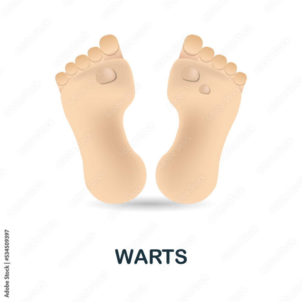 Warts icon. 3d illustration from deseases collection. Creative Warts 3d icon for web design, templates, infographics and more Warts icon. 3d illustration from deseases collection. Creative Warts 3d icon for web design, templates, infographics and more