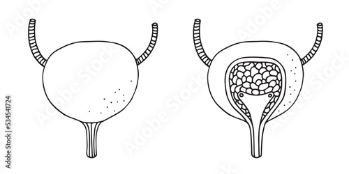 Vector illustration of a human bladder with incision