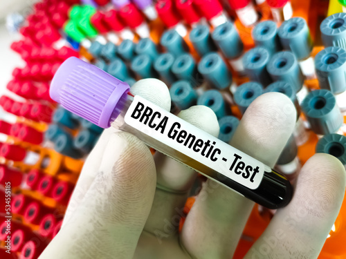 BRCA1 and BRCA2 are two genes that are important to fighting cancer called tumor suppressor genes. photo