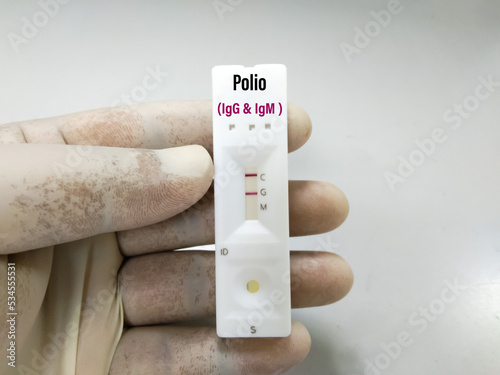 Rapid test cassette for Polio virus IgG and IgM. Positive result showing. photo
