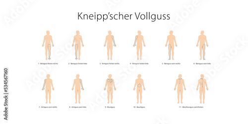 Schaubild Plakat Kneipp'sche Güsse nach Sebastian Kneipp - Vollguss mit deutscher Beschriftung