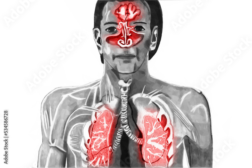 Cold Upper respiratory tract exposed. Vector in low poly style.