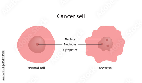 The structure of the cancer cell. Vector illustration.