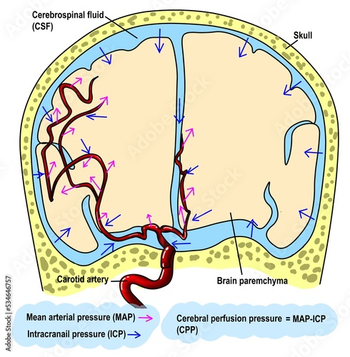 The cerebral perfusion pressure (CPP) is the determinant of how much of blood flow feeding into the brain.  photo