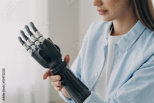 Obraz na plátně Disabled girl touches her bionic prosthetic arm