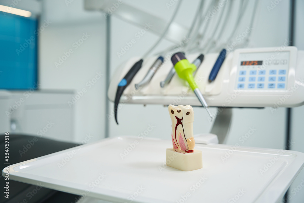 Ταπετσαρία Close-up of tooth model with root canals and caries