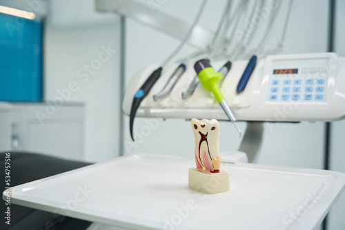 Bilde på lerret Close-up of tooth model with root canals and caries