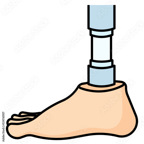 prosthesis