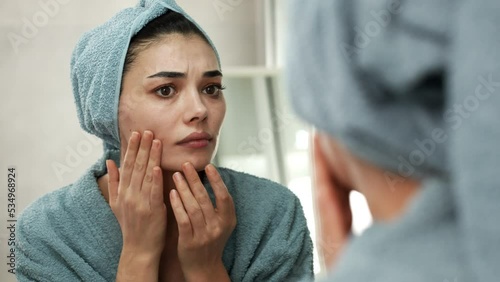 Woman squeezing a pimple on her face photo