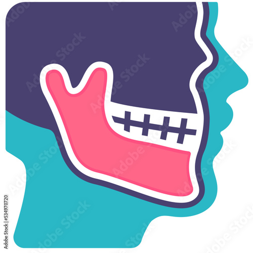 Jaw x-ray