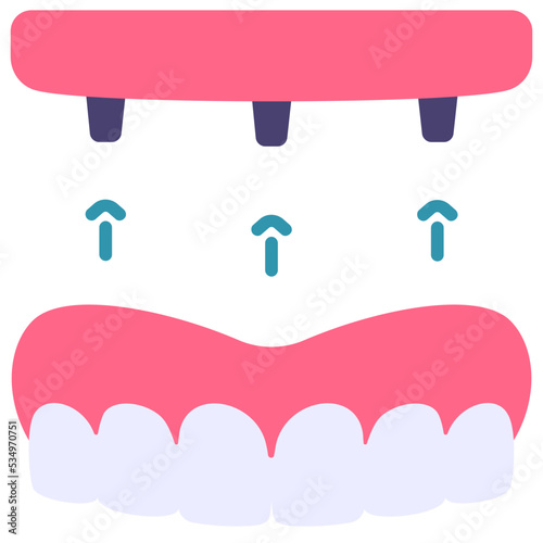 Dentures screw