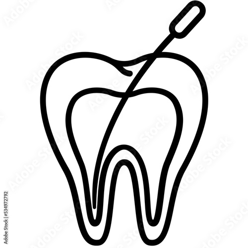 Root canal