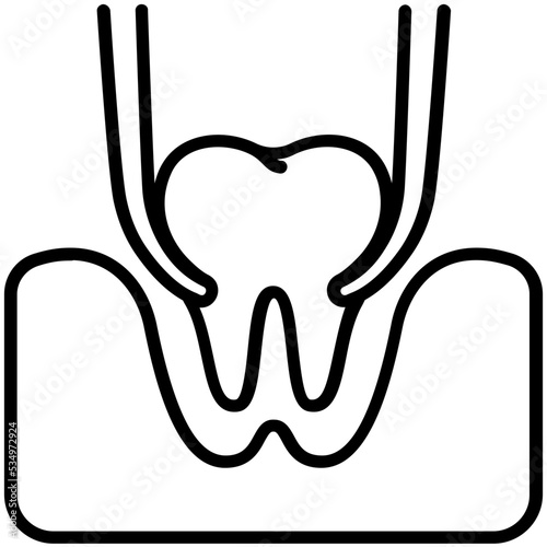 Tooth extraction