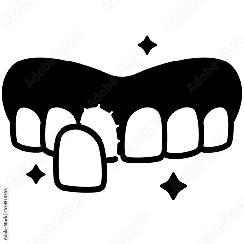 Veneers