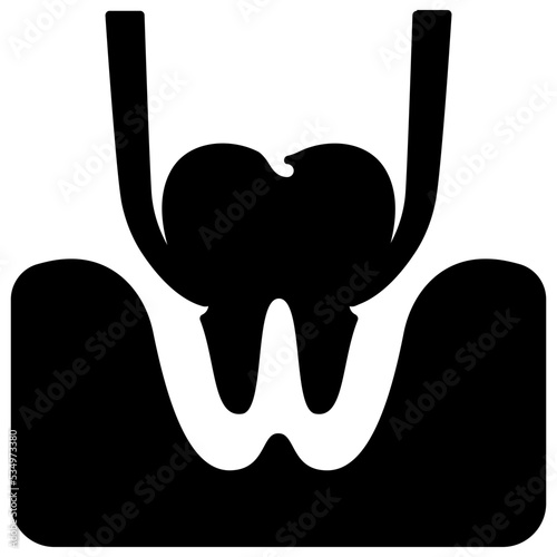 Tooth extraction
